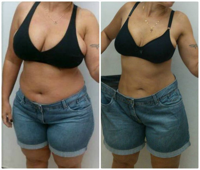 Imagen publicada en la galería de LipoBlue Boost