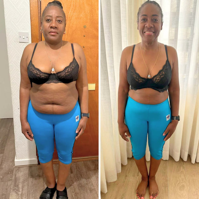 Imagen publicada en la galería de LipoBlue Boost