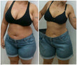 LIPOBLUE BOOST